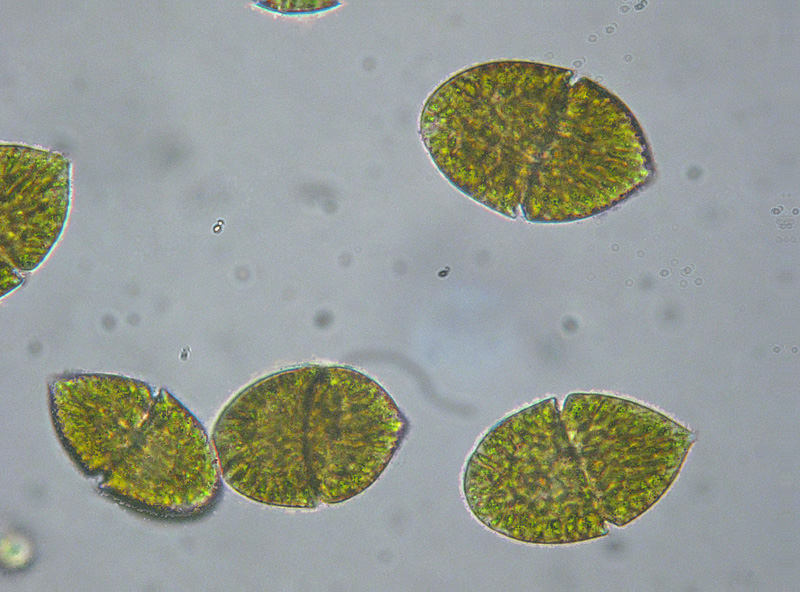 Dalla Lagozzetta di Besnate